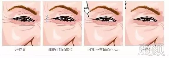 https://img.miyanlife.com/mnt/timg/190128/1216134604-11.jpg