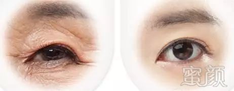https://img.miyanlife.com/mnt/timg/190128/1216136435-10.jpg