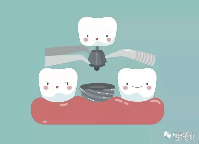 https://img.miyanlife.com/mnt/timg/190128/12325CA3-0.jpg