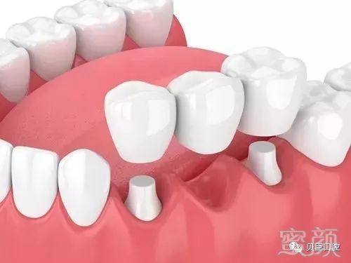 https://img.miyanlife.com/mnt/timg/190128/12325M939-1.jpg