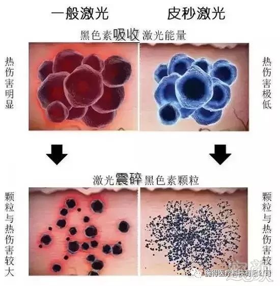 https://img.miyanlife.com/mnt/timg/190128/12425Ba2-3.jpg
