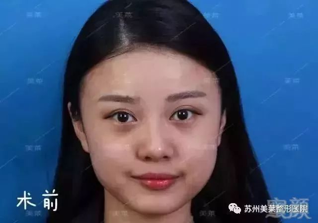 https://img.miyanlife.com/mnt/timg/190129/1142522401-3.jpg