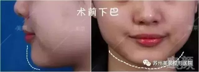 https://img.miyanlife.com/mnt/timg/190129/1142523C0-4.jpg