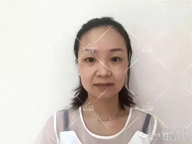 https://img.miyanlife.com/mnt/timg/190129/11425363B-9.jpg