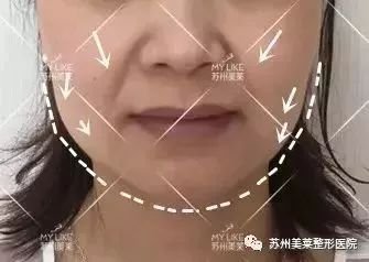 https://img.miyanlife.com/mnt/timg/190129/114253B02-10.jpg
