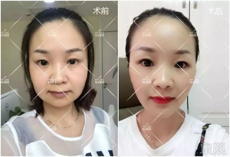 https://img.miyanlife.com/mnt/timg/190129/114253CP-14.jpg