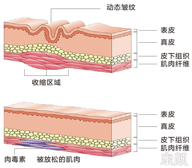 案例图片