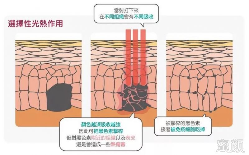 https://img.miyanlife.com/mnt/timg/190129/12300V339-1.jpg