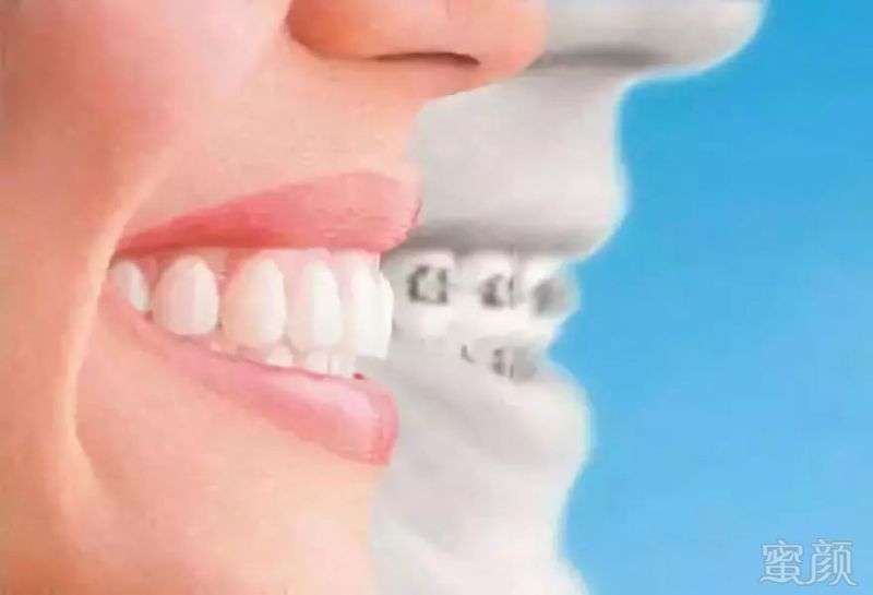 https://img.miyanlife.com/mnt/timg/190129/125U55317-1.jpg