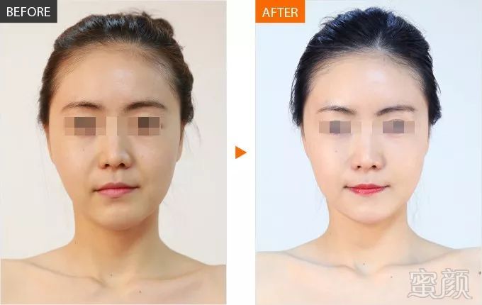 https://img.miyanlife.com/mnt/timg/190130/105U2D17-10.jpg