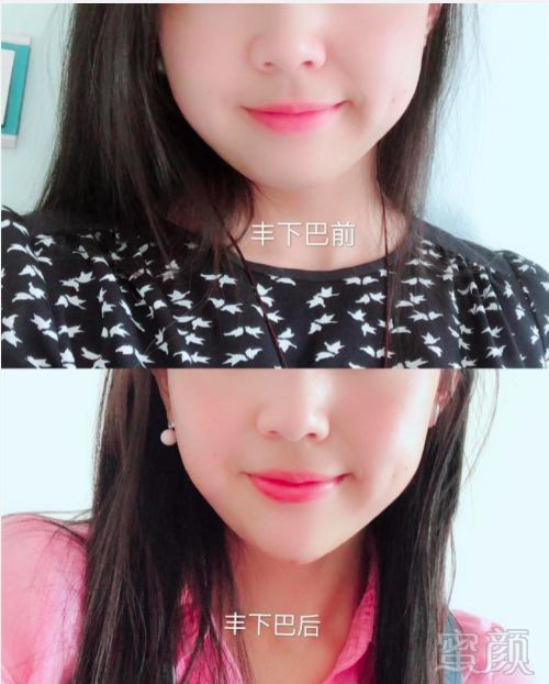 https://img.miyanlife.com/mnt/timg/190130/112301AH-5.jpg