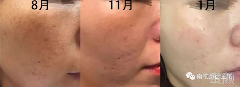 https://img.miyanlife.com/mnt/timg/190130/1221004141-6.jpg