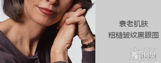 https://img.miyanlife.com/mnt/timg/190130/12244G0b-7.jpg