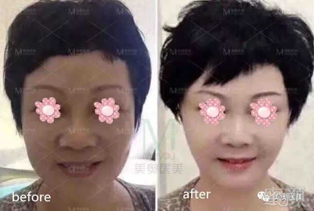 https://img.miyanlife.com/mnt/timg/190130/12244a5A-10.jpg