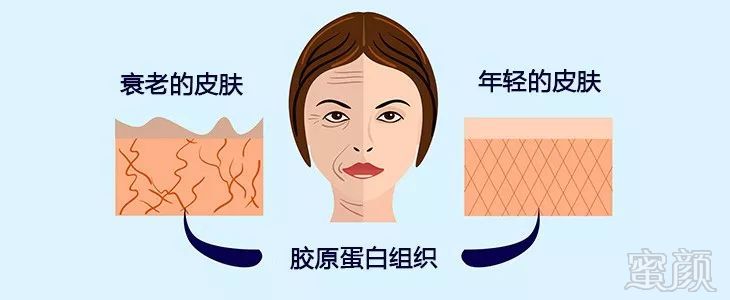 https://img.miyanlife.com/mnt/timg/190130/12263QJ1-1.jpg