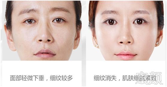 https://img.miyanlife.com/mnt/timg/190130/122S329C-12.jpg