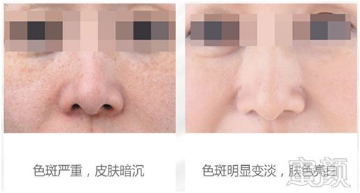 https://img.miyanlife.com/mnt/timg/190130/122S36103-11.jpg