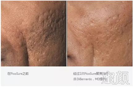 https://img.miyanlife.com/mnt/timg/190130/122S36110-13.jpg