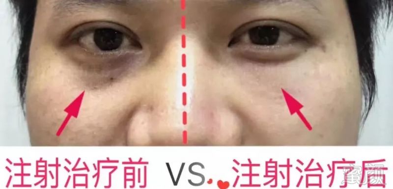 https://img.miyanlife.com/mnt/timg/190130/12313U922-3.jpg