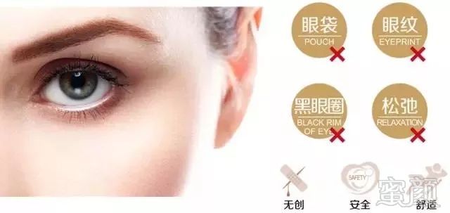 https://img.miyanlife.com/mnt/timg/190130/12313WL9-4.jpg