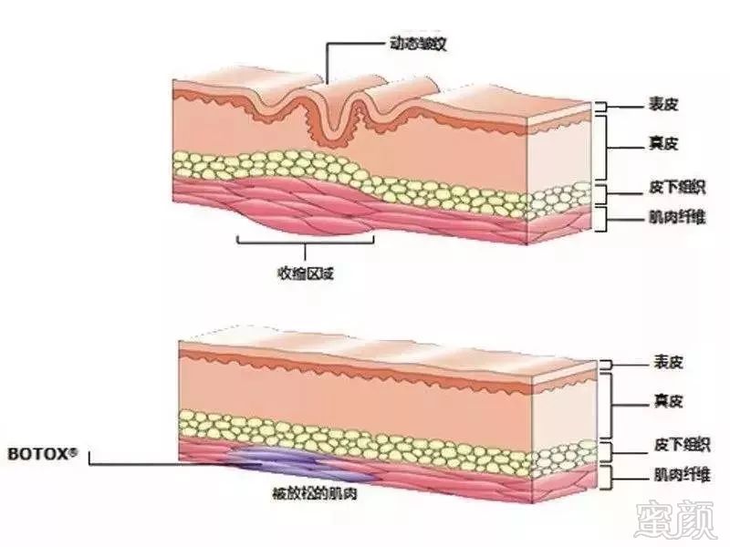 https://img.miyanlife.com/mnt/timg/190130/123K11595-5.jpg