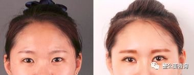 https://img.miyanlife.com/mnt/timg/190130/12433355a-0.jpg