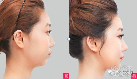 https://img.miyanlife.com/mnt/timg/190130/124334F30-6.jpg