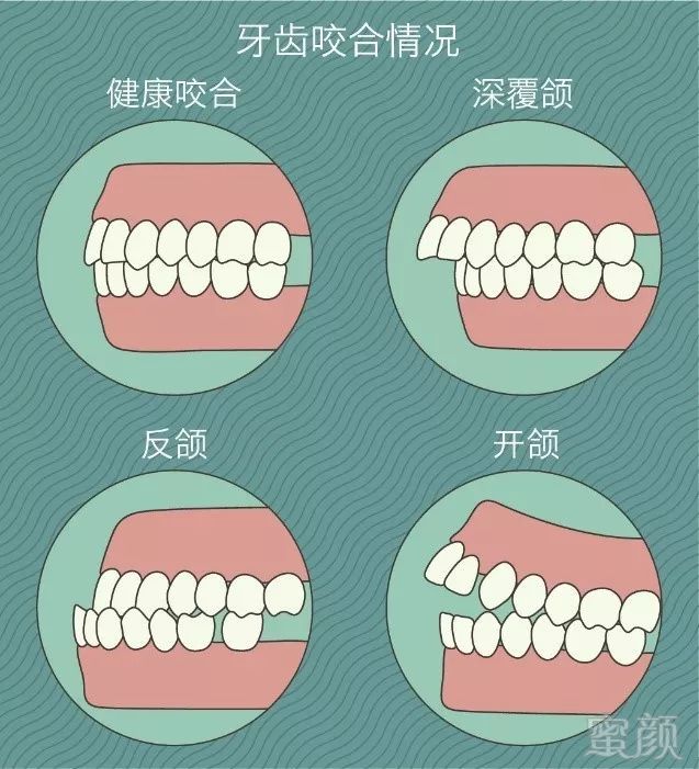 https://img.miyanlife.com/mnt/timg/190131/114235C50-0.jpg