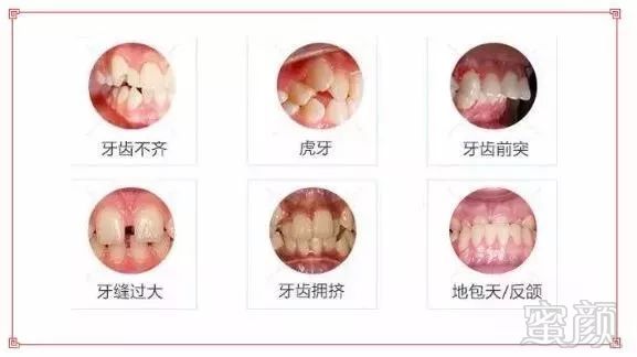 https://img.miyanlife.com/mnt/timg/190131/114U64H3-1.jpg