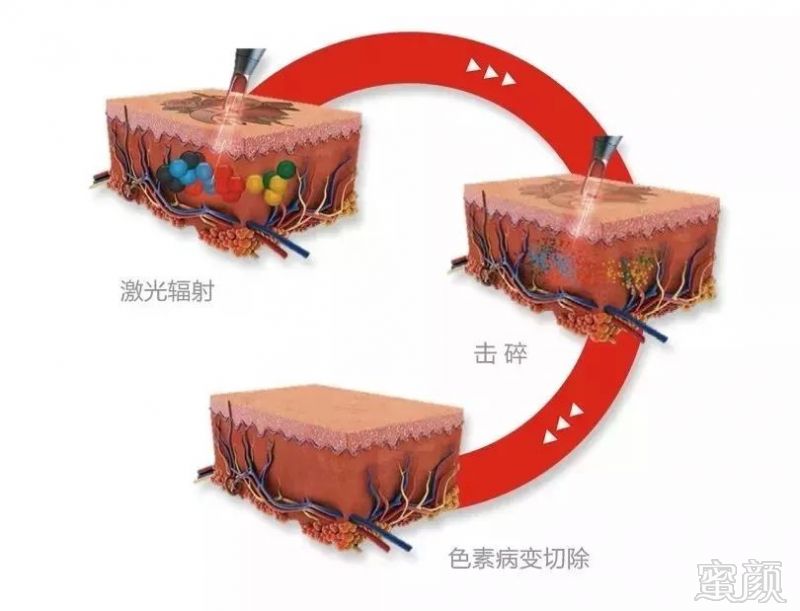 https://img.miyanlife.com/mnt/timg/190131/1211193253-2.jpg