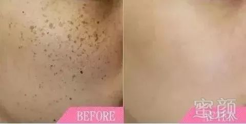 https://img.miyanlife.com/mnt/timg/190131/1213141506-9.jpg