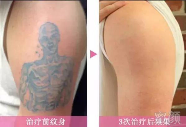 https://img.miyanlife.com/mnt/timg/190131/1213143Y0-10.jpg
