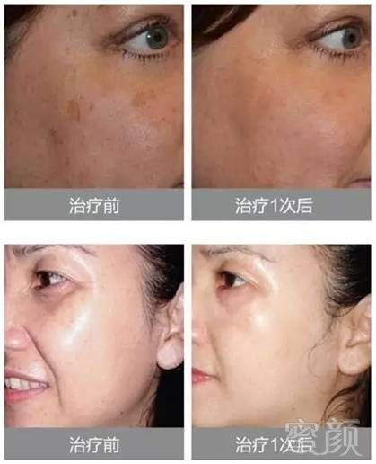 https://img.miyanlife.com/mnt/timg/190131/1215421933-10.jpg