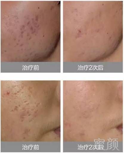 https://img.miyanlife.com/mnt/timg/190131/12154220N-11.jpg