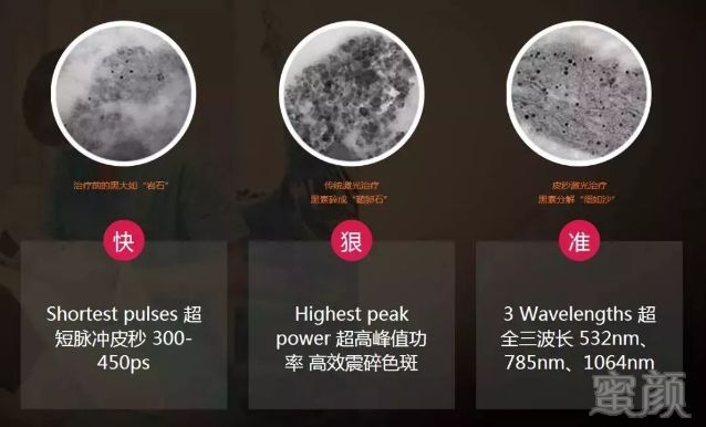https://img.miyanlife.com/mnt/timg/190131/1216352495-8.jpg