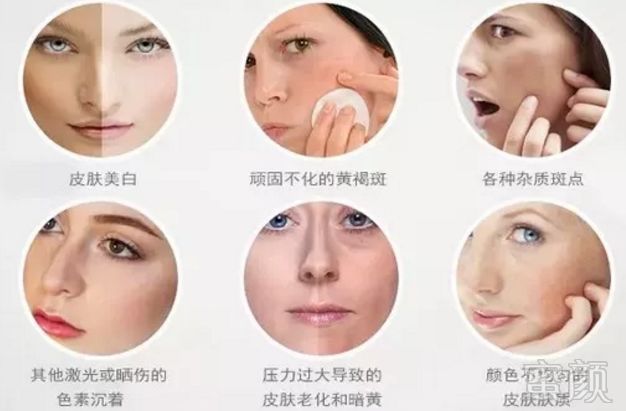 https://img.miyanlife.com/mnt/timg/190131/12163542W-9.jpg