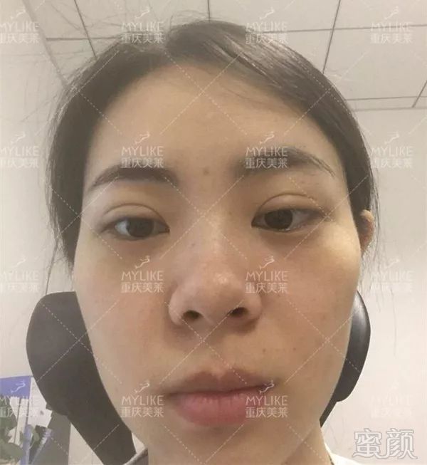https://img.miyanlife.com/mnt/timg/190131/12445455c-0.jpg