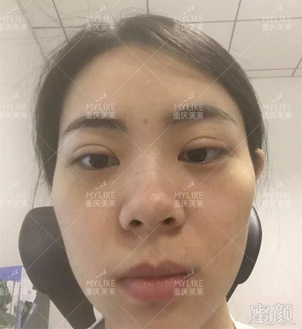 https://img.miyanlife.com/mnt/timg/190131/1245011Q1-8.jpg