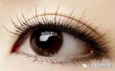 https://img.miyanlife.com/mnt/timg/190131/1252452235-0.jpg