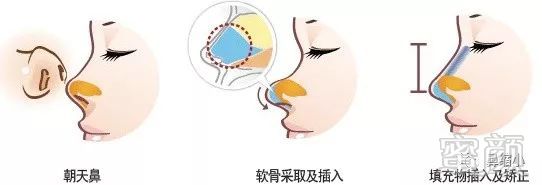 https://img.miyanlife.com/mnt/timg/190201/124TQ935-9.jpg