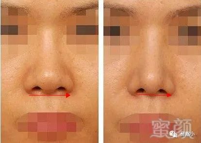 https://img.miyanlife.com/mnt/timg/190201/124TR923-8.jpg