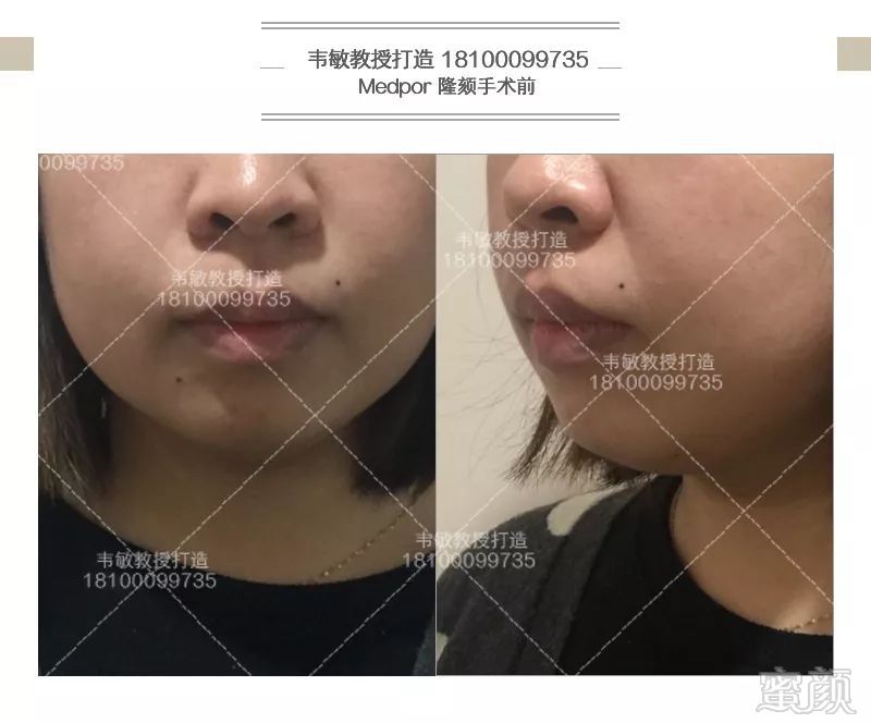 https://img.miyanlife.com/mnt/timg/190201/1253214O1-3.jpg