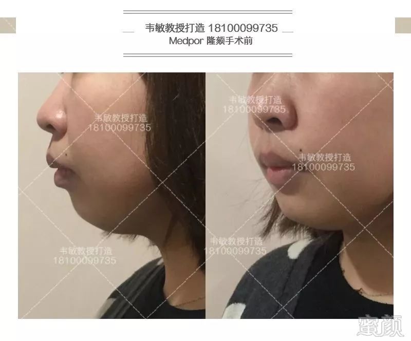 https://img.miyanlife.com/mnt/timg/190201/1253216309-2.jpg