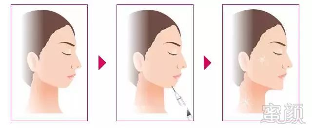 https://img.miyanlife.com/mnt/timg/190201/13052330J-8.jpg