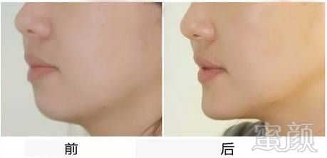 https://img.miyanlife.com/mnt/timg/190201/13052333b-9.jpg