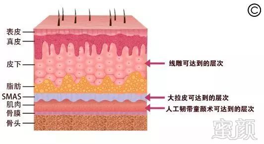 https://img.miyanlife.com/mnt/timg/190201/1319162K2-2.jpg
