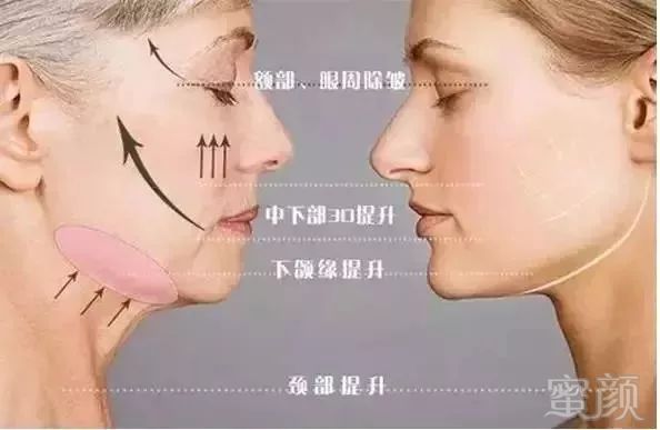 https://img.miyanlife.com/mnt/timg/190201/1319193457-8.jpg