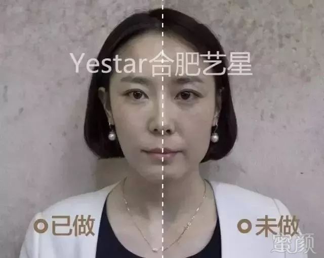 https://img.miyanlife.com/mnt/timg/190201/13191S2F-6.jpg