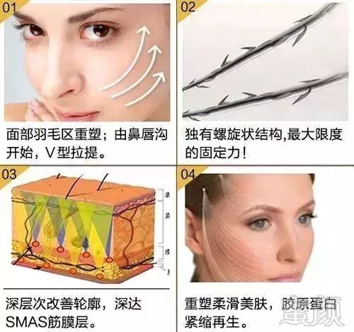 https://img.miyanlife.com/mnt/timg/190201/13191VH9-5.jpg