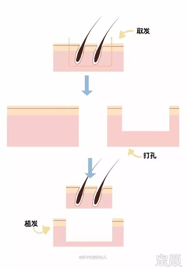 案例图片